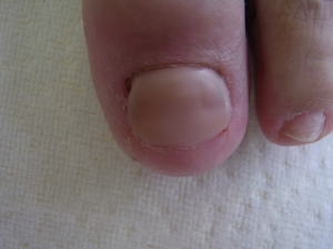 nagel na reparatie met gel