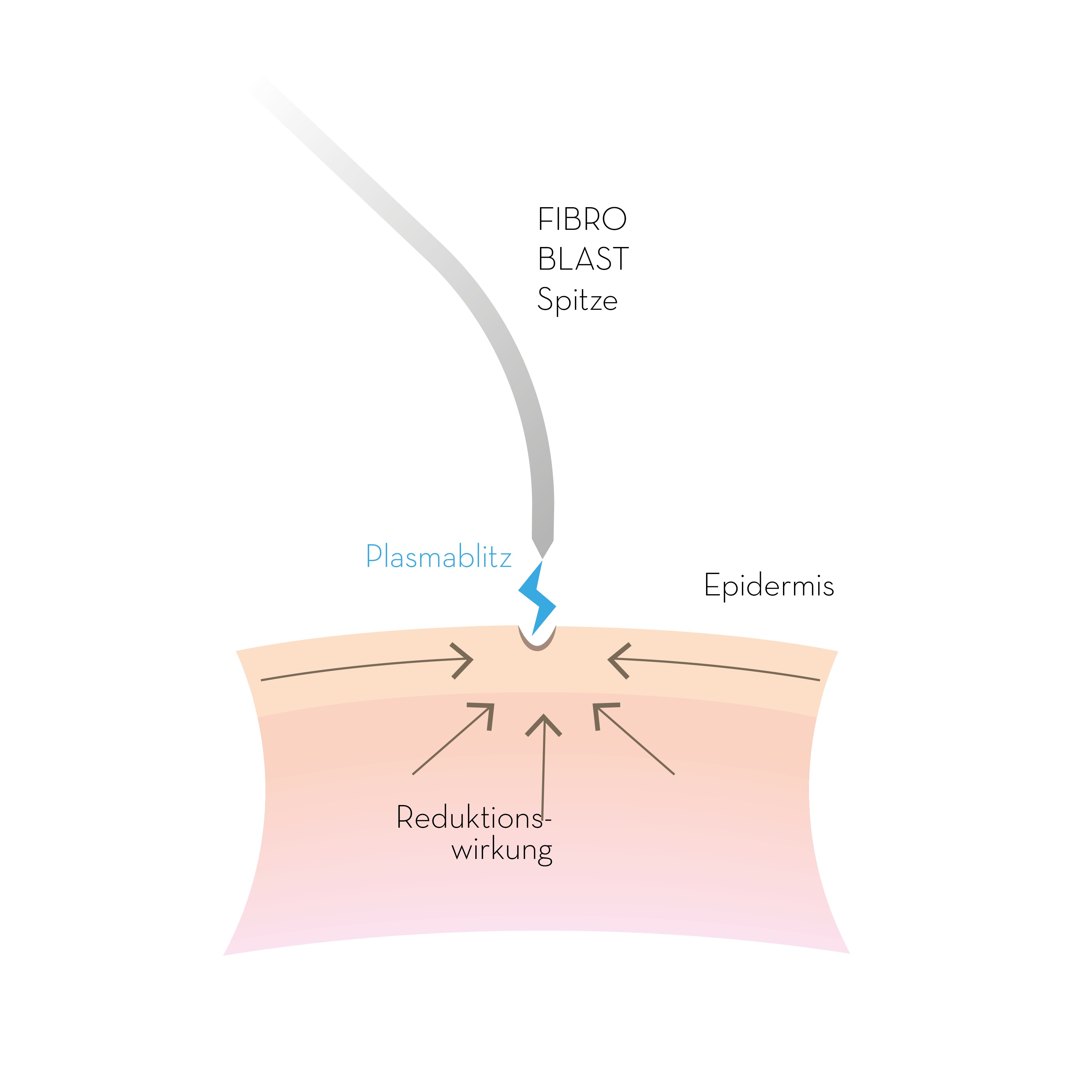purebeau fibroblast rimpelbehandeling