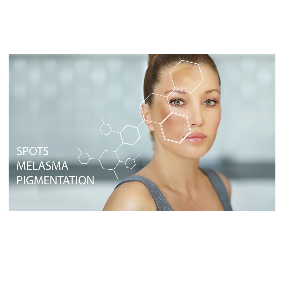 Hyperpigmentatie en Spot Out Kit behandeling Schoonheidssalon Deborah